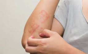 Best Skin, Sexual & Allergy Disease Specialist Doctor - Doctor Khulna